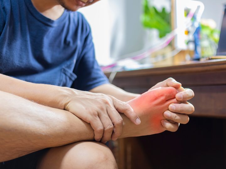 10 Jenis Makanan Picu Terjadi Asam Urat