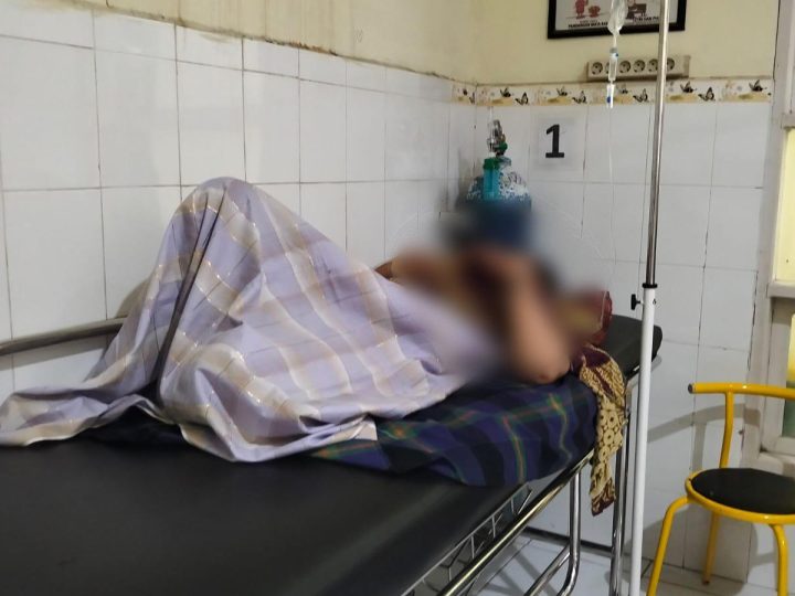 IRT di Pinrang jadi Korban KDRT, Diduga Disiram Air Keras Suaminya